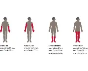 Zusätzliches Produktbild für Nässeschutz