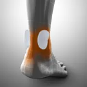 Zusätzliches Produktbild für Sportlastic Achillessehnenbandage Achillodyn