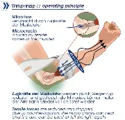 Zusätzliches Produktbild für Masalo Manschette