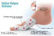 Zusätzliches Produktbild für Hallufix Hallux Valgus Schiene mit Gelkissen